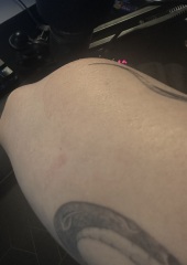 New tattoo, Second skin reaction.. what do I do?