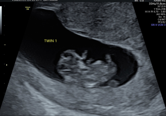 OCTOBER 2024 BABIES :) THREAD 3