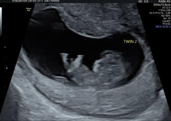 OCTOBER 2024 BABIES :) THREAD 3