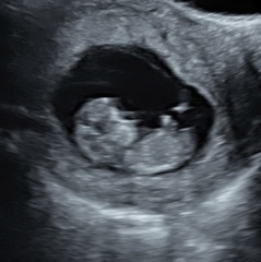 This is bad news isn’t it? (Scan photos included)