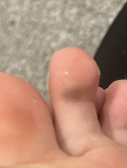 What is this mark on my child’s thigh??