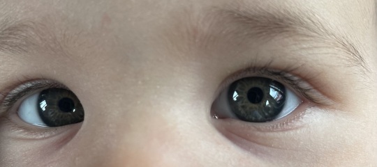Eye colour