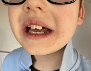 Face rash/spots? Any ideas?