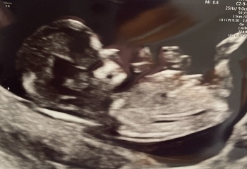 Boy or girl?