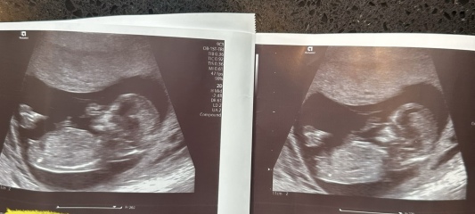 Gender guesses just for fun? Nub theory