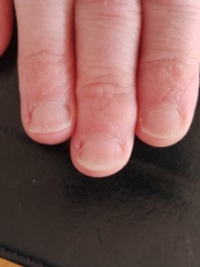 I need really basic advice about my nails.
