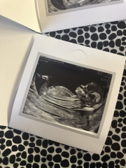 Boy or girl?!