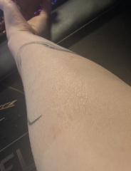 New tattoo, Second skin reaction.. what do I do?