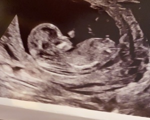 Please help...12+3 days...boy or girl?