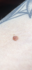 Does this mole warrant any concern?