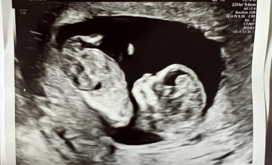 Boy or girl scan guess