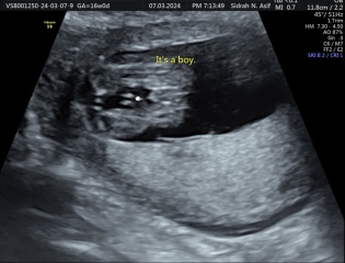 16 week scan, is it right?