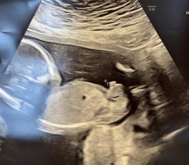 Boy or girl