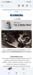 Stacked nub, 20 week scan girl?