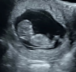 This is bad news isn’t it? (Scan photos included)