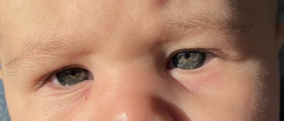 Eye colour