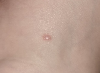 Is this worth getting checked?