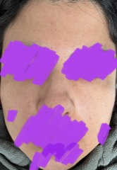 What skin undertone do you think I am?