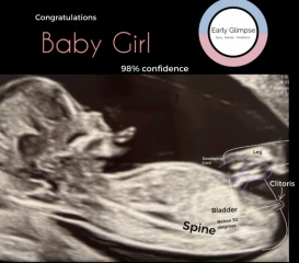 Gender scan booked but any last minute guesses at nub theory?