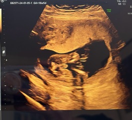 Boy or girl