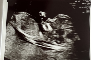 Boy or girl scan guess