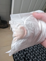 Twitching in uterus during TWW?????