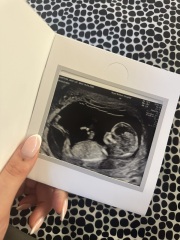 Boy or girl?!