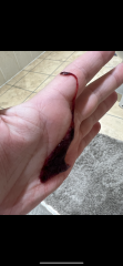 *trigger warning* help please, miscarriage or not?