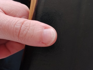 I need really basic advice about my nails.