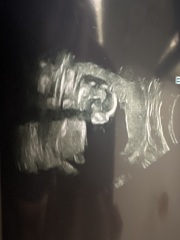 Scan picture inbetween the legs! Boy or girl?