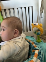 Is this Plagiocephaly? Also, does plageodephaly cause brain damage/delays?