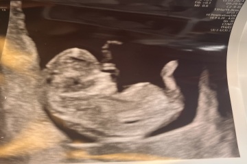 Nub theory- boy or girl?