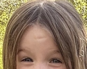 My baby dented her forehead on the skirting board. I am so upset. Pic included.