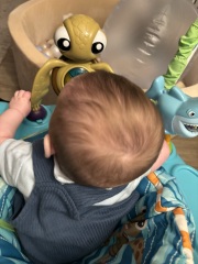 Is this severe flat head?