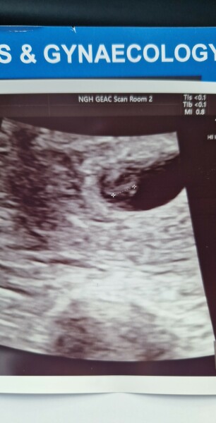 Dec-Christmas Babys 2024