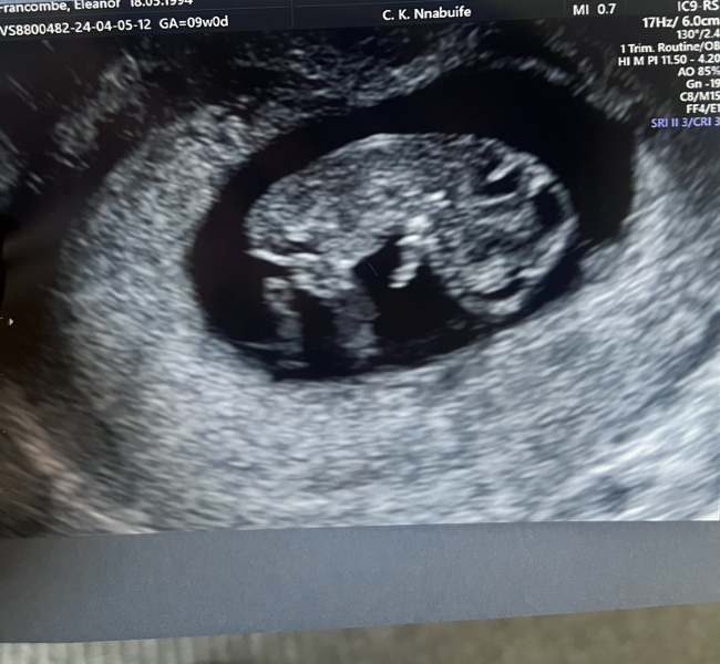 November 2024 Babies- Part 2!