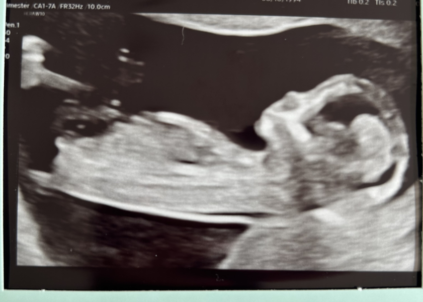 OCTOBER 2024 BABIES :) THREAD 3