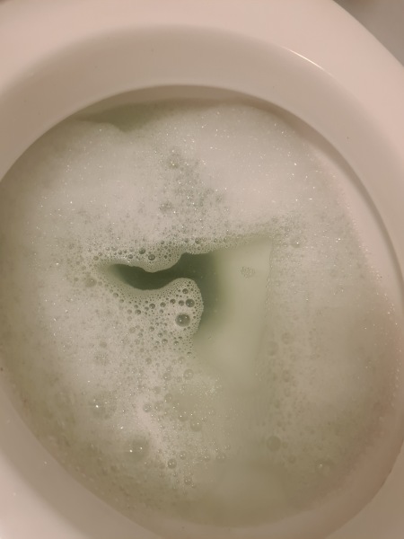 Please Help the toilet is blocked