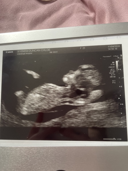 OCTOBER 2024 BABIES :) THREAD 3