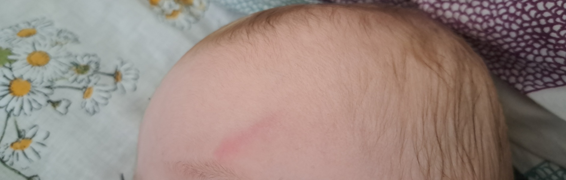 9 month old bumped head onto wooden base of sofa