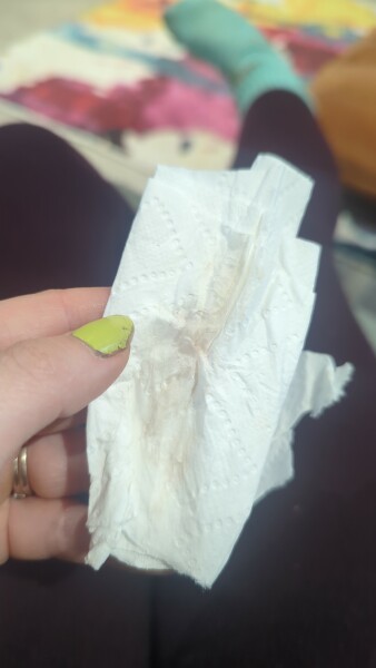 Pregnancy after loss support