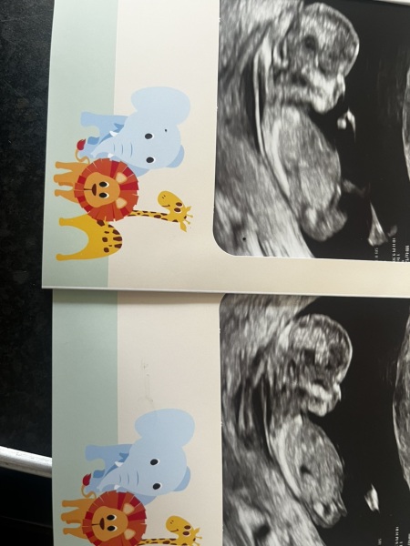 Boy or girl?