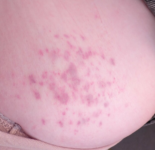 Is this concerning (pic)?