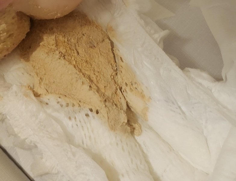 19 month old poop very pale