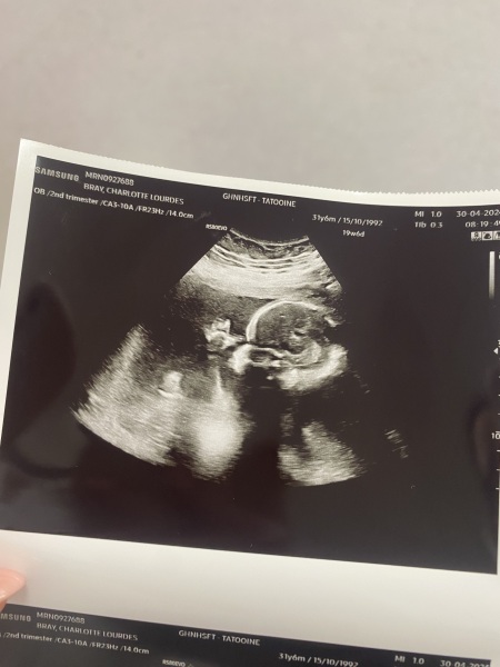 September 2024 - Thread 6! 🐣🧡💛❤️