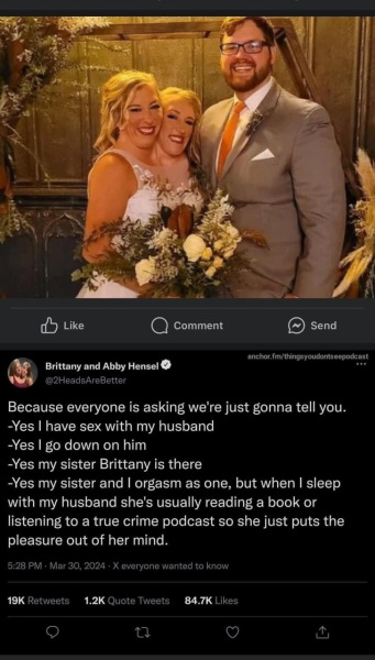 None of our business but (conjoined twins.. NSFW potentially)