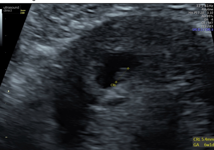 Dec-Christmas Babys 2024