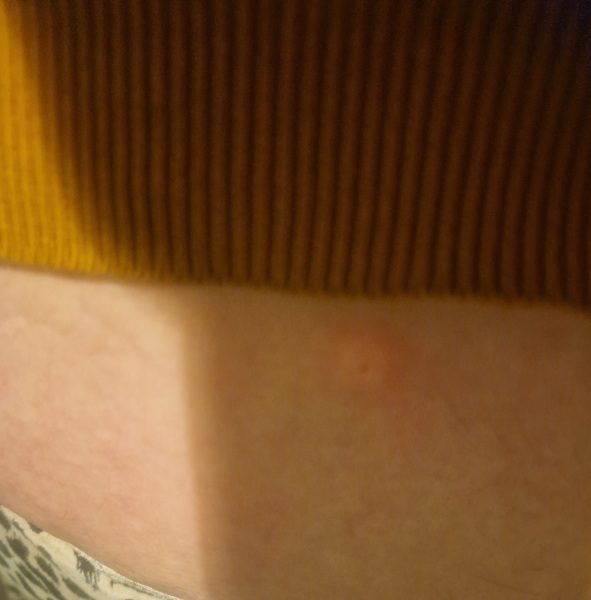 Continuing Mounjaro...part 5