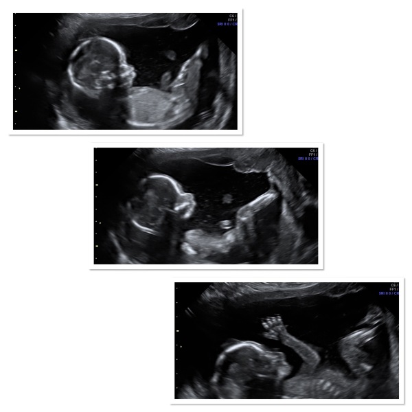 Due September - Thread 5! 🐣❤️🧡💛