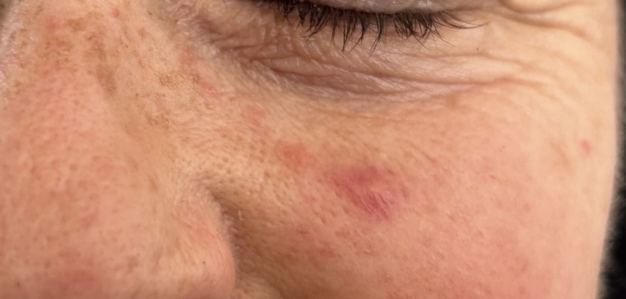 Thoughts on these spots please ?